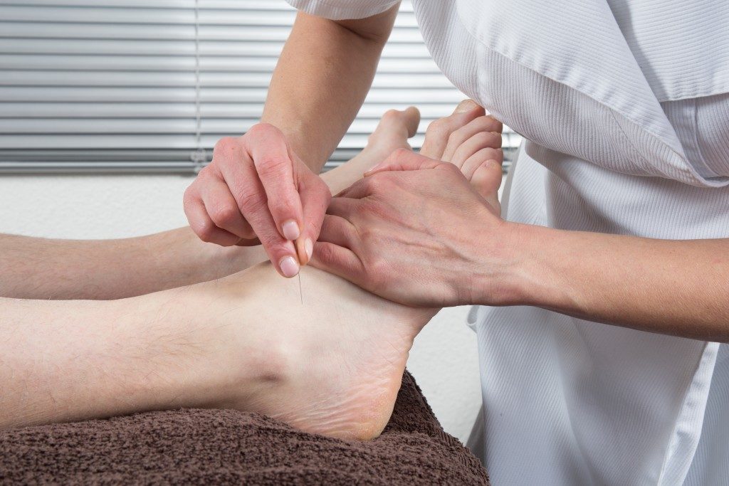 Dry needling treatment at Pride Podiatry